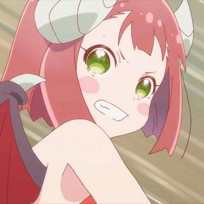 11岁女孩患肝衰竭和白血病双眼变绿
